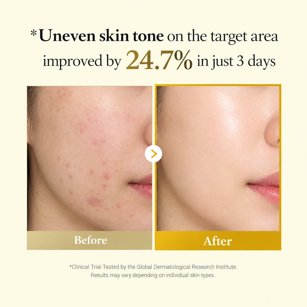 Before and after comparison of uneven skin tone improvement with text indicating 24.7% improvement in 3 days.